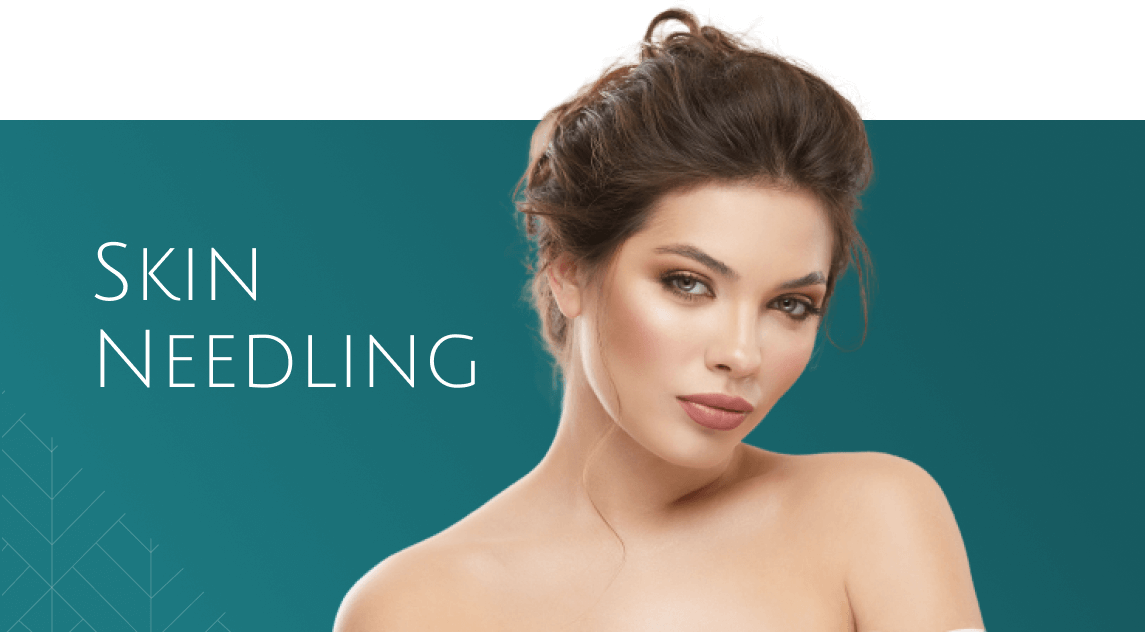 Skin Needling