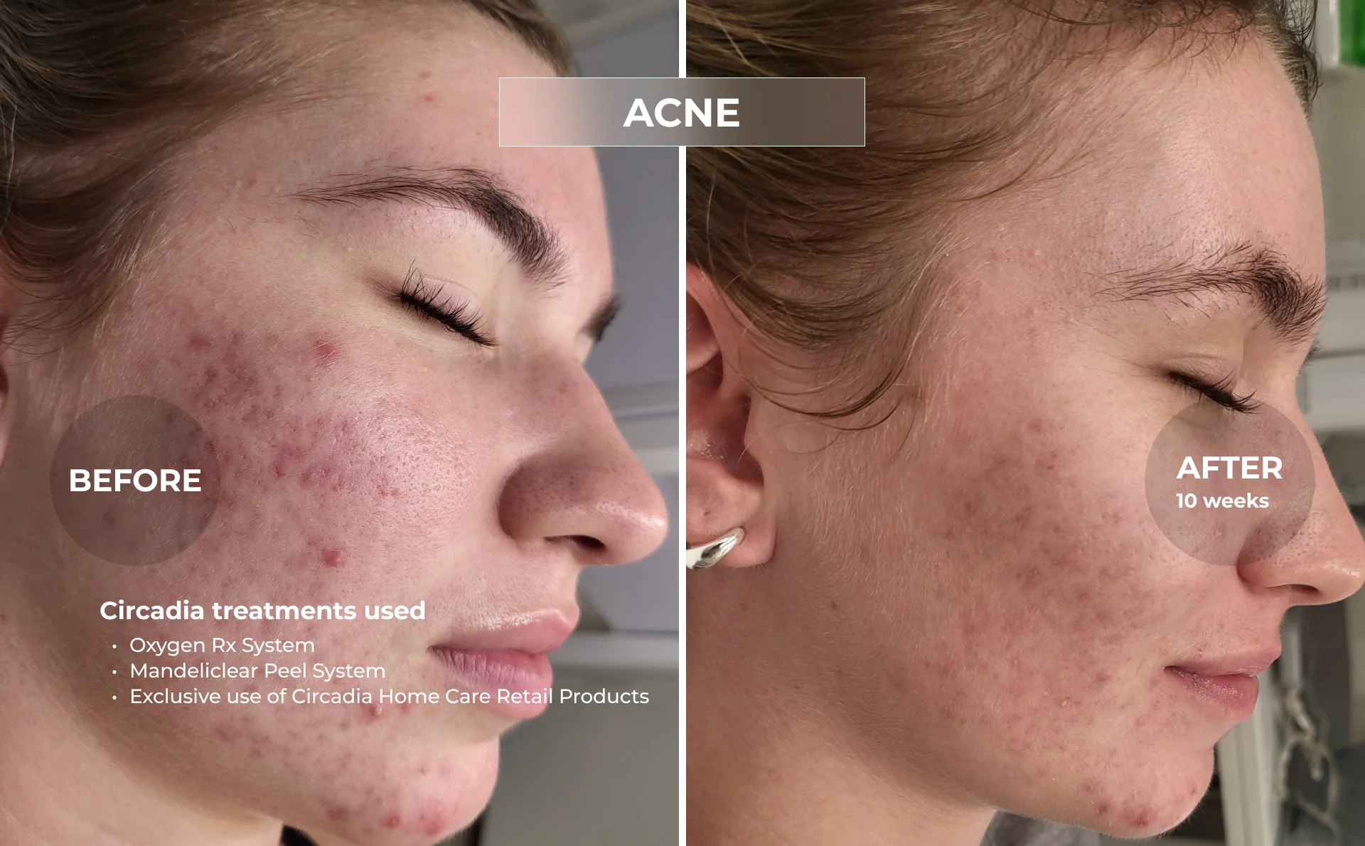 Before and after - congestion and dullness